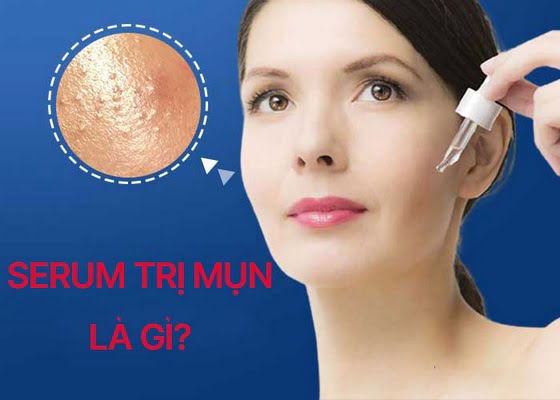 Serum trị mụn chứa đến 70% tinh chất có lợi cho da